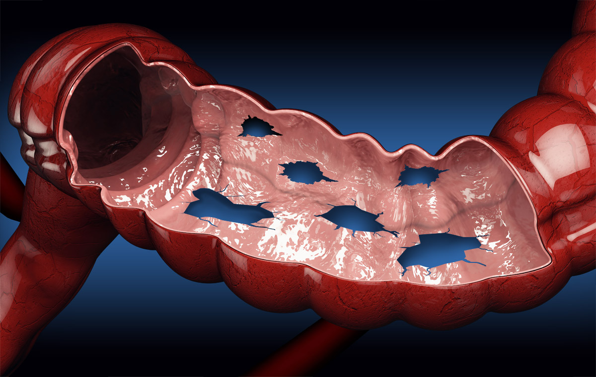 How to save the abdomen?